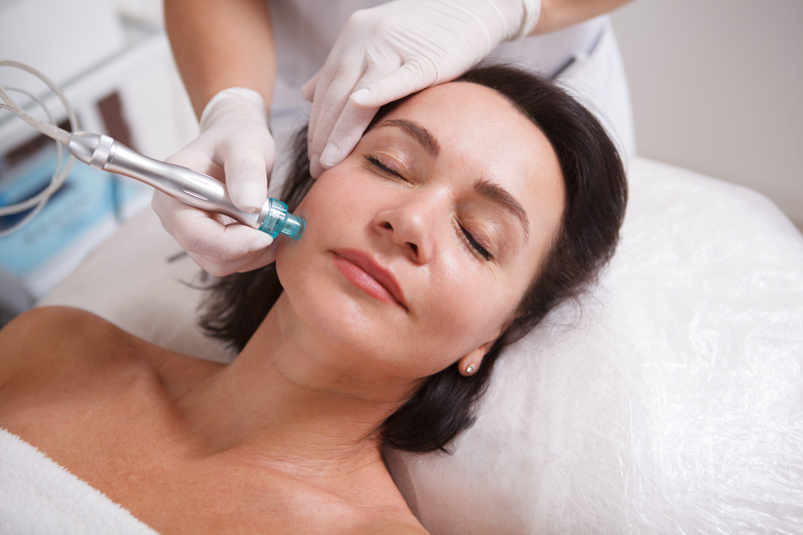 A women getting a professional microneedling treatment
