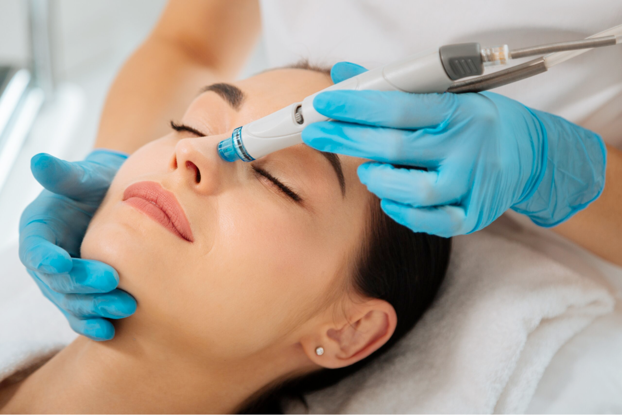 A woman receiving a skin needling treatment