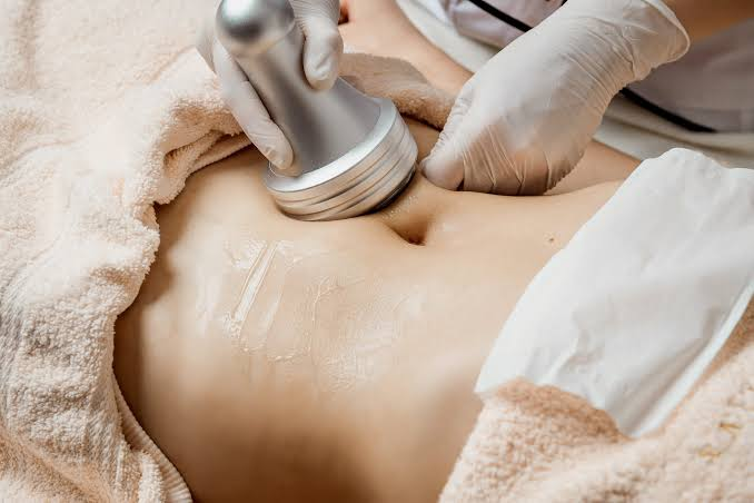 A woman receiving an ultrasound fat cavitation treament